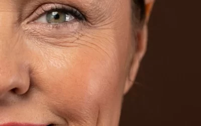 Envelhecimento precoce hábitos que aceleram e como evitar