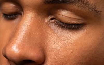 Por que minha pele está sempre oleosa?